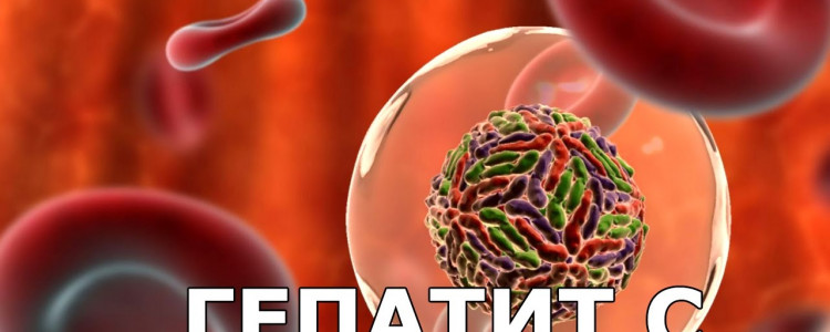 Как лечится вирус гепатита С?