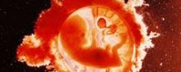 Развитие эмбриона на 3-4 месяце беременности