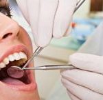 Отбеливание зубов, все за и против