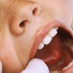 Качество и безопасность стоматологических процедур